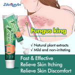 Psoriasis Ointment Supplier - ZouRunAn Quick Effective Skin Discomfort Cream
