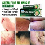 Varicose Veins Supplier - Natural Ingredients Visible Vein Minimizing