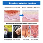 Hemorrhoid Cream Manufacturer - Herbal Massage Crema 20g 0.7oz