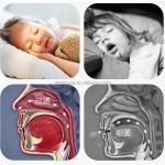 Anti-Snoring Stickers Factory - Adult Children Skin-friendly Lip Patches