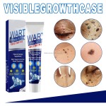 Eye Stickers Supplier - Wholesale Lutein Gel Eye Fatigue Relief