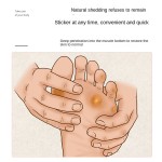 Corn Removal Factory - Plantar Warts Removal Plaster Pads