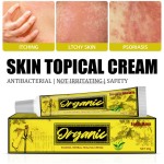 Herbal Cream Supplier - Natural Itch Relief Skin Problems Care