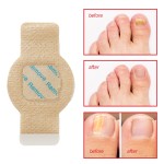 Nail Patches Factory - 21pcs Toenail Treatment 8-Hour Overnight Repair