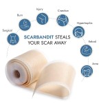 Surgical Scar Tape Factory - Hot Sale 2025 Waterproof Medical Roll