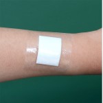 Baby Wound Dressing Manufacturer - China Factory Wholesale Medical PU
