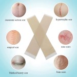 Silicone Gel Patch Factory - Factory Wholesale Reusable Skin Repair