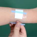 Baby Wound Dressing Manufacturer - China Factory Wholesale Medical PU