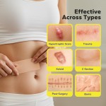 Scar Tape Plaster Supplier - Top Selling Products 2025 Reusable Self-Adhesive