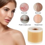 Stretch Mark Patch Manufacturer - Factory Wholesale Ease Silicone Pads