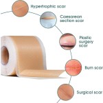 Scar Recovery Tape Factory - Factory Wholesale Cheap Price Silicone
