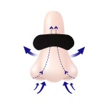 Nasal Strip Supplier - Disposable Clear Breathing Aid Night Snore Reduction