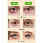 Steam Eye Mask Factory - OEM Disposable Relaxing Home Sleeping