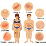 Eczema Relief Manufacturer - OEM Manufacturer Chinese New Soothing Creme