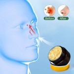 Nose Care Cream Manufacturer - 2025 Trends OEM Rhinitis Balm Allergic Herbal