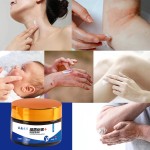 Eczema Cream Supplier - OEM Lightening Herbal Antifungal Anti-Itch Ointment