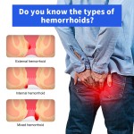 Hemorrhoids Ointment Supplier - Best Price Topical Remedy Anal Fissure Removal