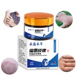 Eczema Cream Supplier - OEM Lightening Herbal Antifungal Anti-Itch Ointment
