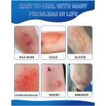 Burn Ointment Manufacturer - High Effective Scald Wound Herbal Repair