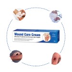 Burn Ointment Manufacturer - Effective Scald Wound Repair Anti-Infection