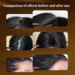 Anti-Hair Loss Shampoo Supplier - Custom Ginger Formula Hair Strengthening Shampoo