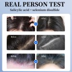 Shampoo with Salicylic Acid Factory - OEM Anti-Dandruff Volumizing Shampoo for Oily Scalp