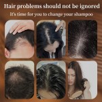 Anti-Hair Loss Shampoo Supplier - Custom Ginger Formula Hair Strengthening Shampoo
