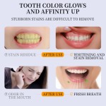 Toothpaste Manufacturer - OEM Hydroxyapatite Deep Cleaning Mint Toothpaste