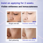 Whitening Cream Factory - ODM 377 Freckle Removing Moisturizing Face Cream