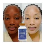 Vitamin C Softgels Supplier - OEM Glutathione Skin Whitening Brightening