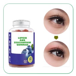 OEM Vitamin C E Zinc Lutein Gummies Health Supplement Lutein Zeaxanthin Gummies for Adults and Kids