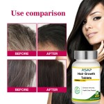 Hair Growth Tablets Supplier - OEM Women Vitamin C Biotin Support