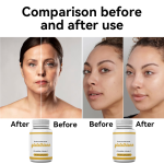 Glutathione Collagen Capsules Supplier - OEM Soft Capsules Skin Whitening