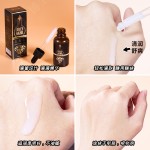 Whitening Essence Manufacturer - OEM Chloasma Spot Sunburn Care