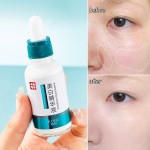 Whitening Essence Factory - OEM Chloasma Age Spot Sunburn Care