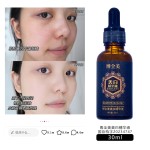 Skin Care Essence Manufacturer - OEM Whitening Freckle Moisturizing