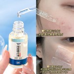 Acne Essence Manufacturer - OEM Liquid Treatment Reduce Scars
