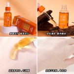 Whitening Essence Supplier - OEM Freckle Removing Lighten Spots