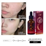 Ginseng Essence Supplier - OEM Anti Wrinkle Firming Moisturizing