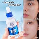 Whitening Essence Manufacturer - OEM Freckle Removing Lighten Spots