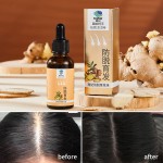Ginger Hair Liquid Supplier - OEM 30ml Herbal Treat Hair Loss