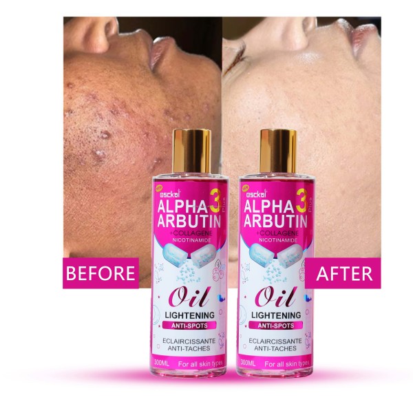 Lighting Oil Factory - Alpha Arbutin Collagen Anti-aging