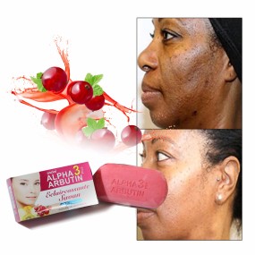 Face Soap Manufacturer - Alpha Arbutin 250g Cleansing Firming