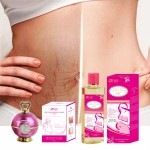 Stretch Mark Kit Supplier - Rose Cream Body Oil Removal