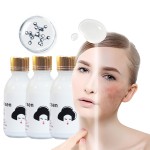 Whitening Serum Supplier - Brightening Dark Spot Removal 125ml