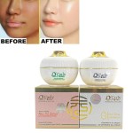 Face Cream Manufacturer - Anti Aging Collagen Black Spot