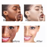 Whitening Oil Supplier - Ginger Oil 1000ml Moisturizing