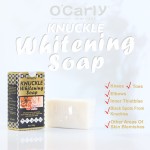 Whitening Set Manufacturer - Knuckle Lightening Elbows Knees