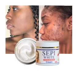 Face Cream Factory - SEPI Whitening Anti-Pimple 100G