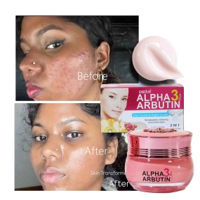 Face Cream Supplier - Alpha Arbutin Collagen Firming
